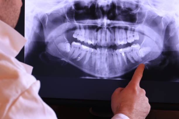 Best Emergency Treatment for Dental Infections or Abscesses in Paisley, FL